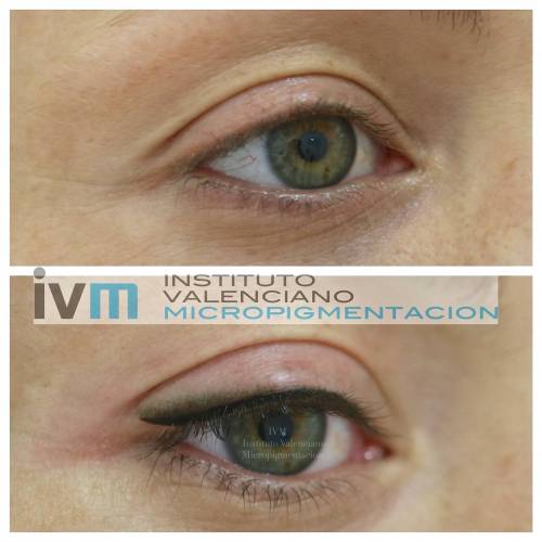 Foto INSTITUTO VALENCIANO MICROPIGMENTACION