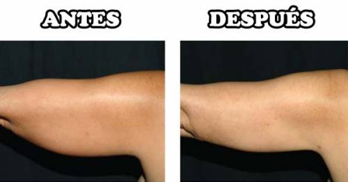 Foto Fortis medicina natural SL