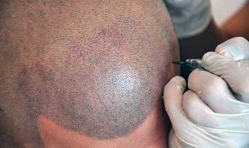 Micropigemtacion capilar desde 350? por zona