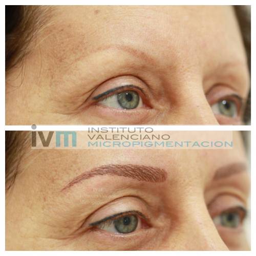 Foto INSTITUTO VALENCIANO MICROPIGMENTACION