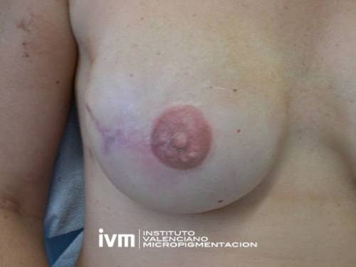 Foto INSTITUTO VALENCIANO MICROPIGMENTACION