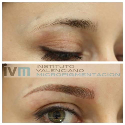 Foto INSTITUTO VALENCIANO MICROPIGMENTACION