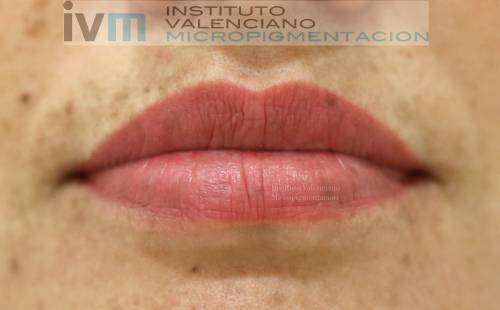 Foto INSTITUTO VALENCIANO MICROPIGMENTACION
