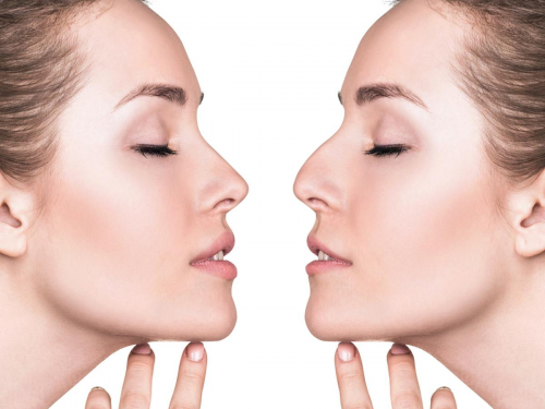 Cirug�a Pl�stica