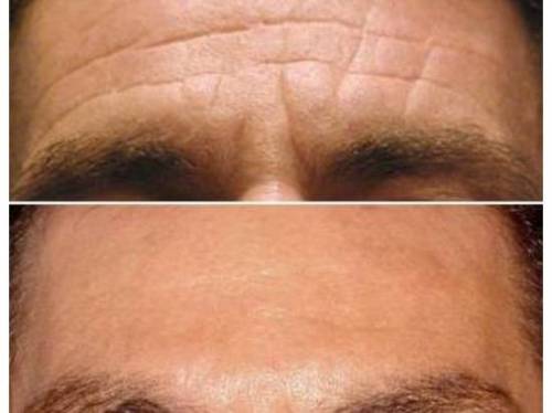 Foto Cl�nica Burbaro