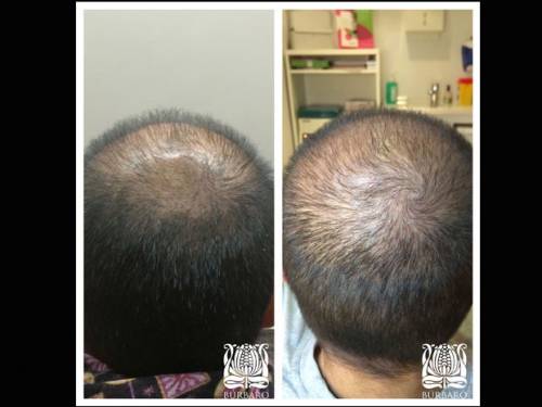 Foto Cl�nica Burbaro