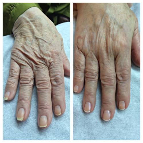 Foto Cl�nica Burbaro