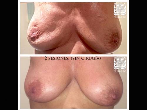 Foto Cl�nica Burbaro