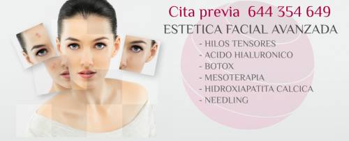 Botox, �cido hialur�nico, hilos tensores, hidroxiapatita c�lcica, mesoterapia, needling, peeling, blefaroplastica qu�mica y mucho m�s...