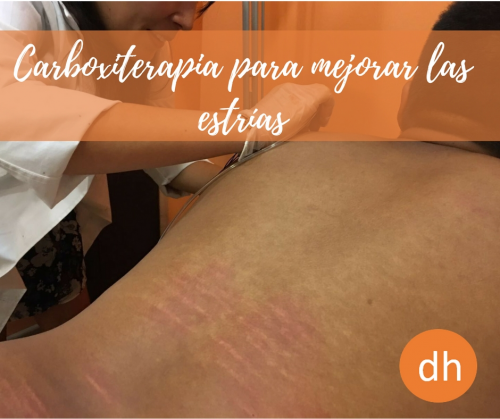 Foto Cl�nicas DH - Medicina Est�tica Avanzada