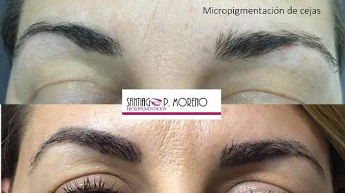 Foto Santi P Moreno Micropigmentaci�n Sevilla