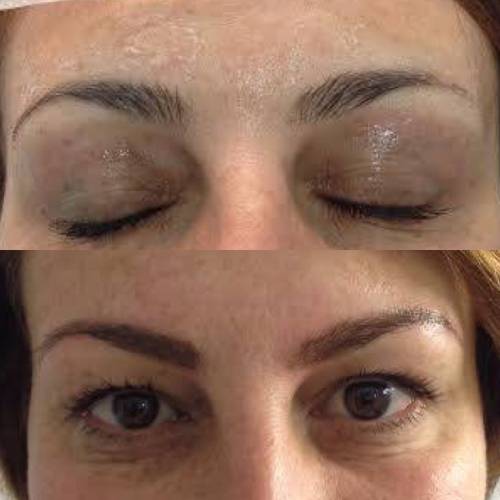 Foto Santi P Moreno Micropigmentaci�n Sevilla
