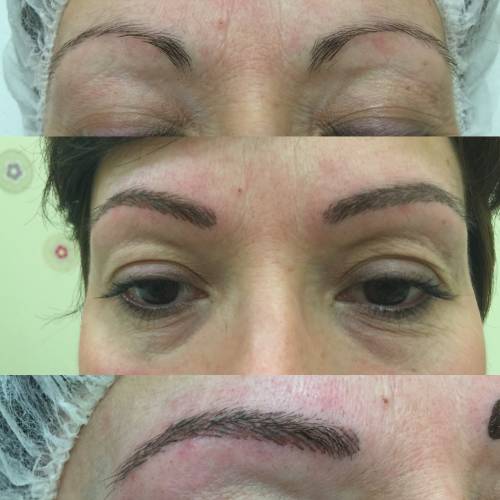 Foto Santi P Moreno Micropigmentaci�n Sevilla