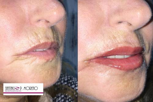 Foto Santi P Moreno Micropigmentaci�n Sevilla
