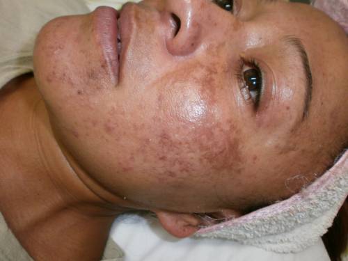 Foto CL�NICA M�DICO EST�TICA MELILLA