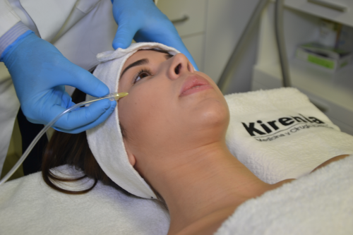 Tratamiento carboxiterapia