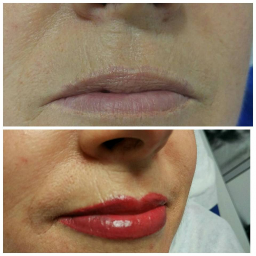 Foto CENTRO DE ESTETICA MAYTE GARRIDO MICROPIGMENTACION SEVILLA