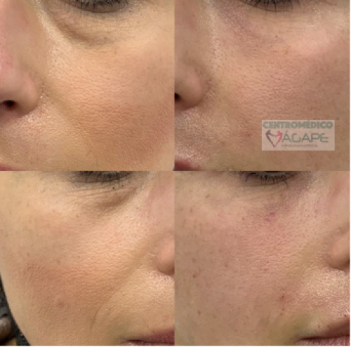 Retoques que realzan tu belleza natural