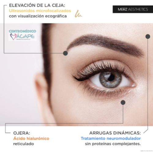 Elevaci�n de cejas