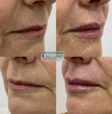 C�digo de barras y labios