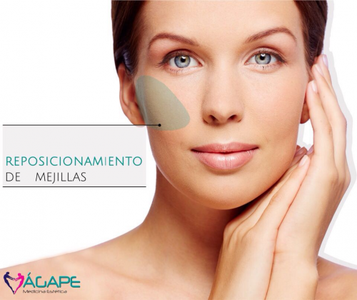 P�mulos con �cido hialur�nico