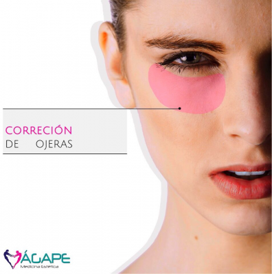 Tratamiento para ojeras