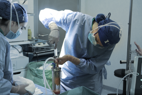 Liposucci�n Agualipo