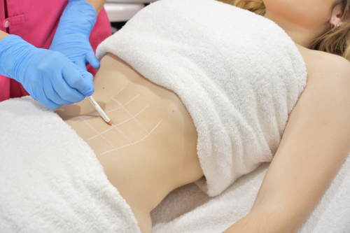 Tratamientos corporales