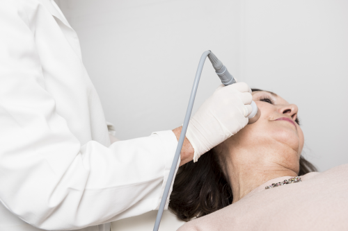 Radiofrecuencia Facial