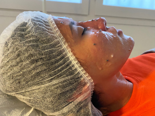 HIGIENE FACIAL