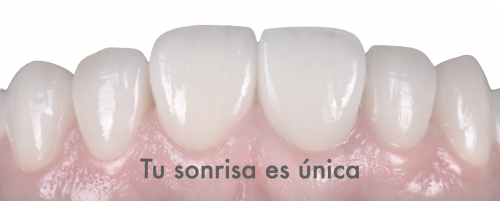 Foto Cl�nica Dental MiBO Almer�a