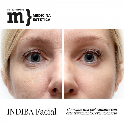 Foto Instituto Marsil