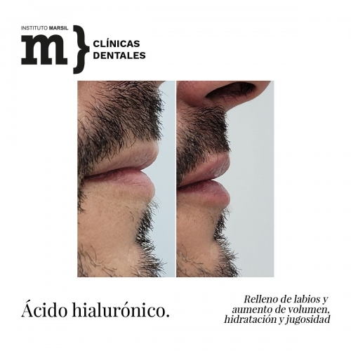 Foto Instituto Marsil