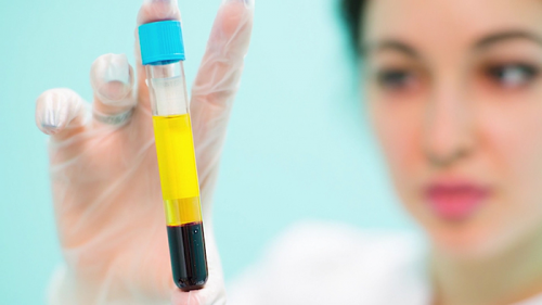 Bioestimulaci�n