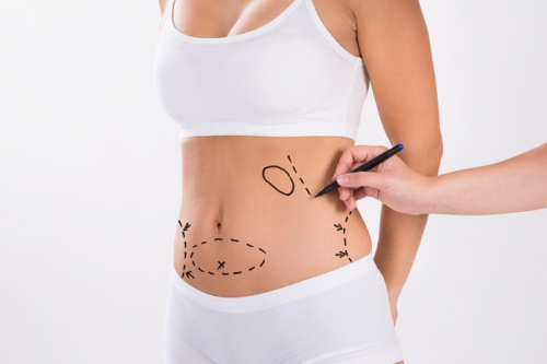 Foto Medcontour