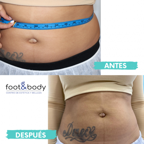 Tratamiento reductor