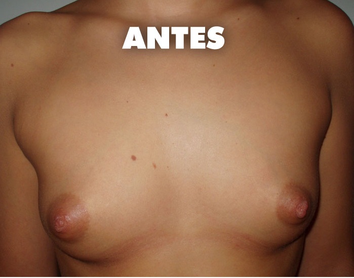 titulo