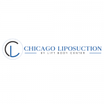 Chicago Liposuction