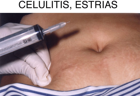 titulo
