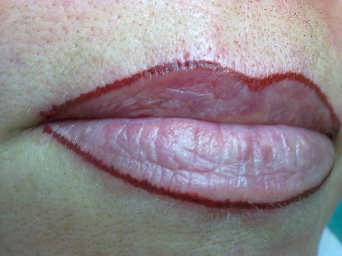 Micropigmentacion de labios