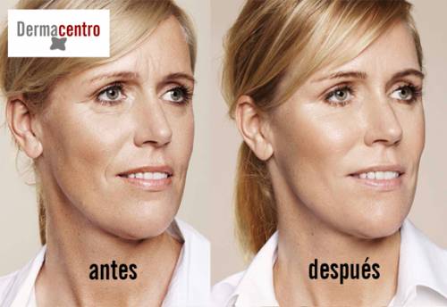titulo