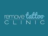 Remove Tattoo Clinic
