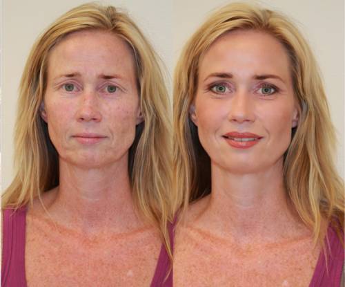 Micropigmentaci�n completa