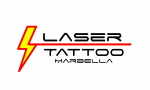 Laser Tattoo Marbella
