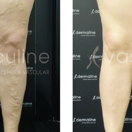 Foto Vasculine - Cl�nica Vascular