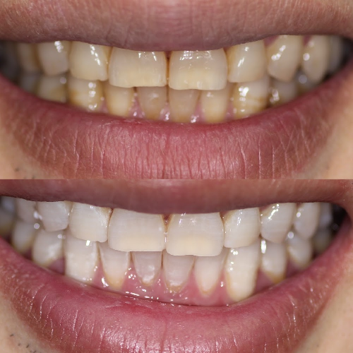 Foto Blue Star Dental Group