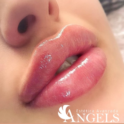 Foto Est�tica Avanzada Angels