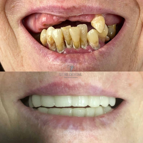Foto Cl�nica Luxe Dental Coslada