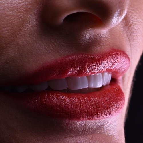 Foto Cl�nica Luxe Dental Coslada