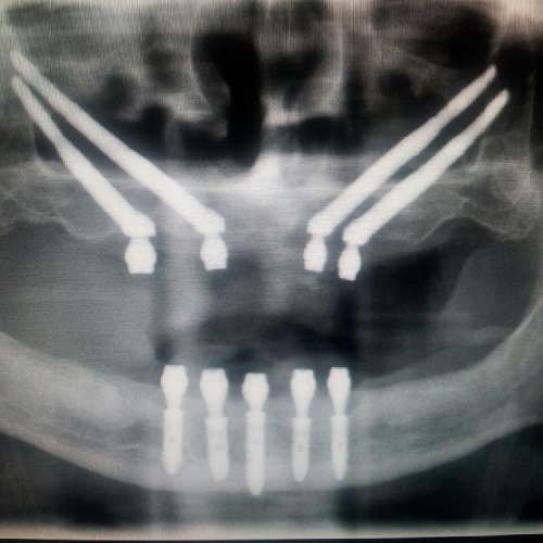 Foto Enric Pintado Cl�nica Dental